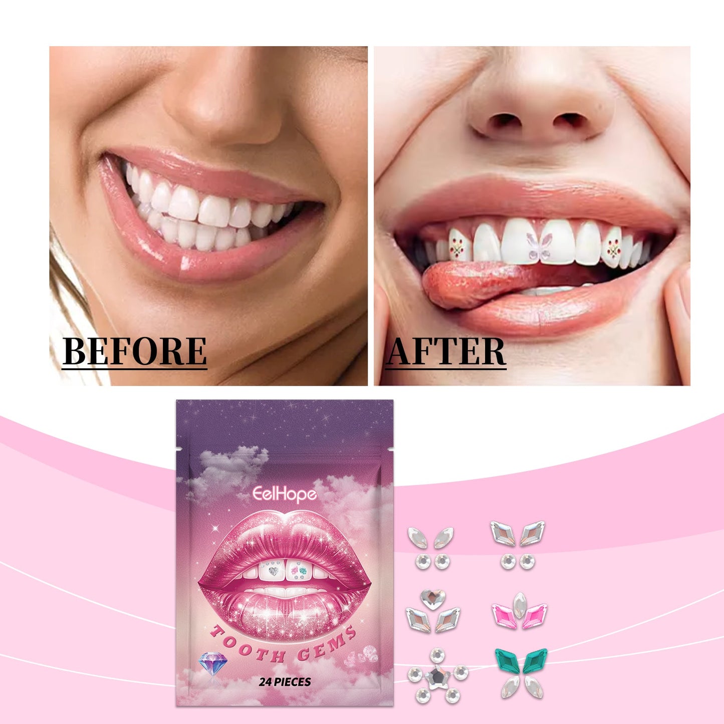 Crystal Dental Drill To Brighten Your Smile For A Long Time With Easy Use Of The Suitable Tooth Type Adhesive