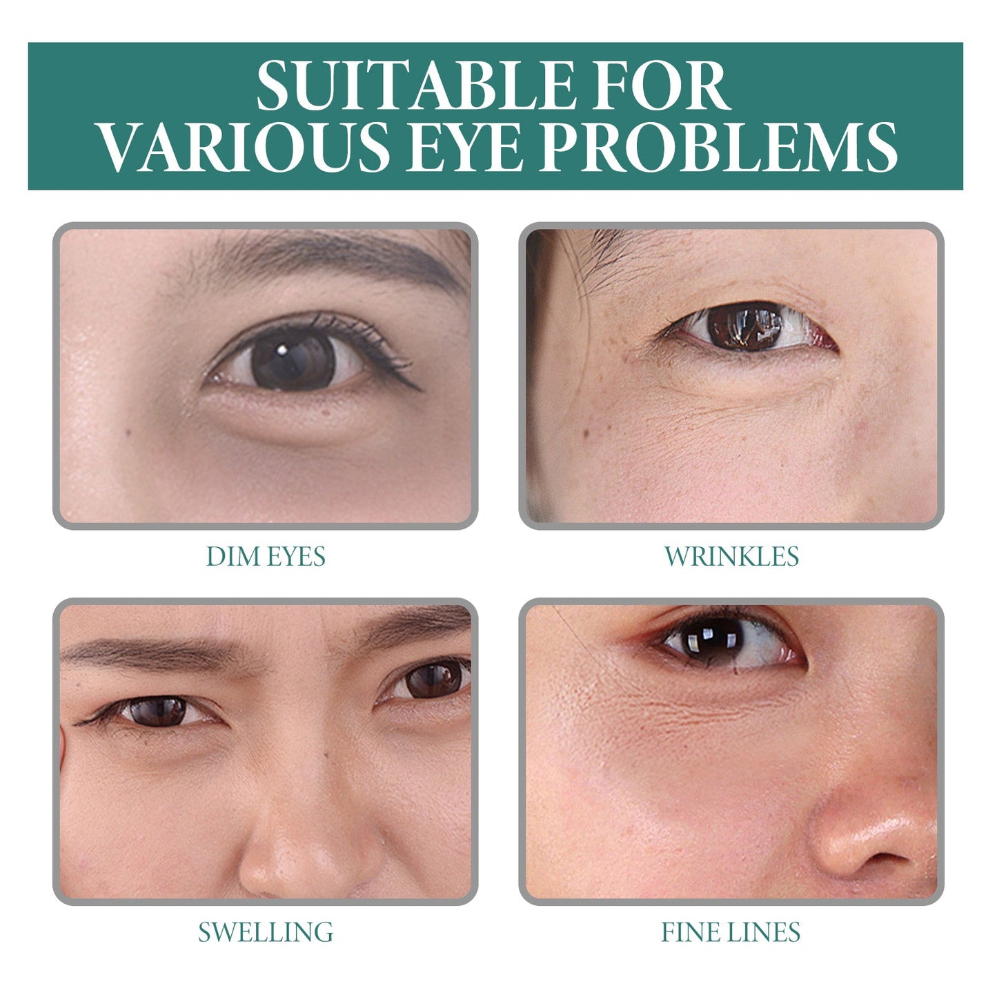 Puffy Eye Serum, Repair Essence Refreshing Hydrating Firming Brightens The Nicotinamide