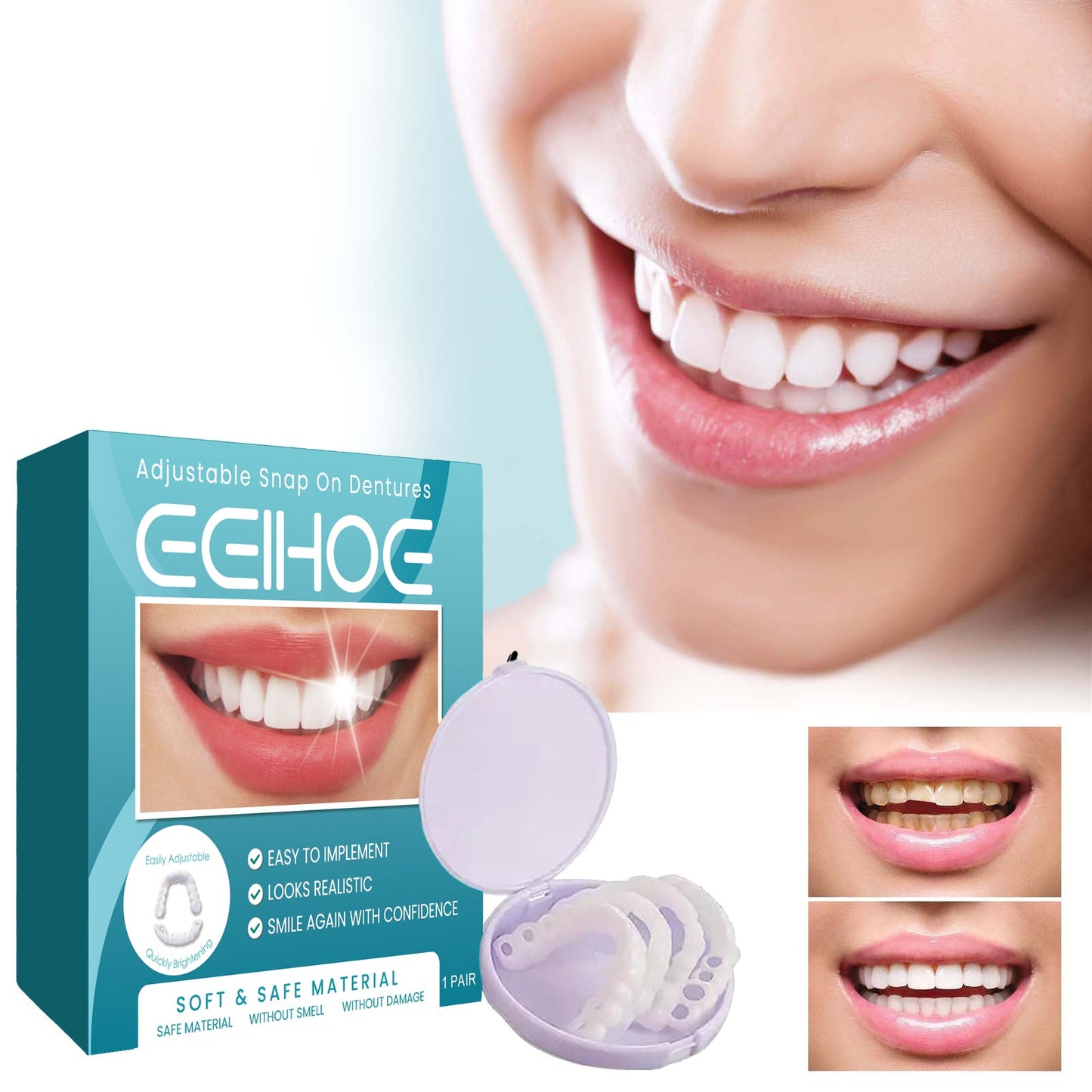Adjustable Buckle Denture, Temporary Fillings Interdental Fillings Orthodontic Denture Kits